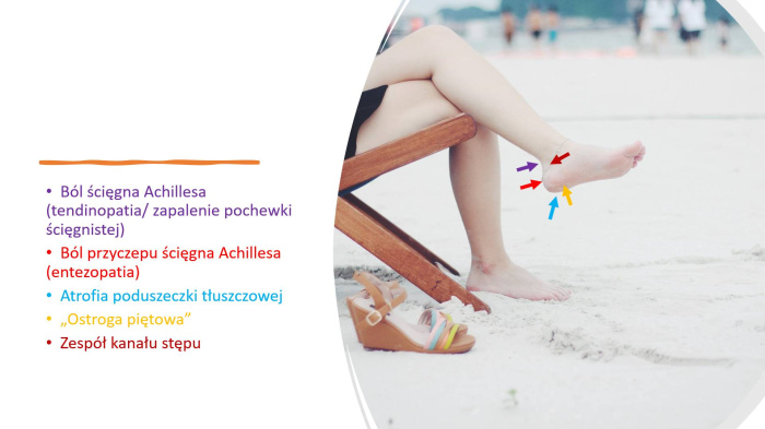 Bole okolicy piety &ndash; przyczyny i leczenie